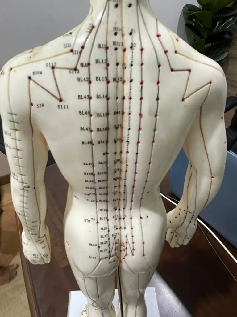 Akupunktur Basic (1-6 Jarum)